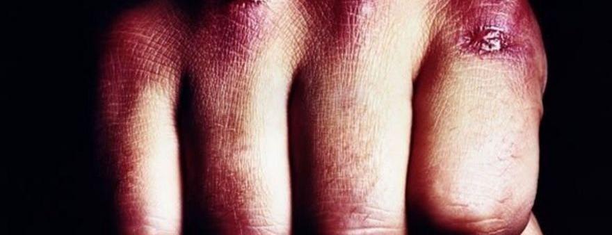  ������� 19-������ ��������� ������ ����� ������� 