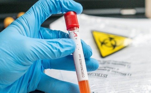  ������ ���� covid-19 ������� ����� ������� 