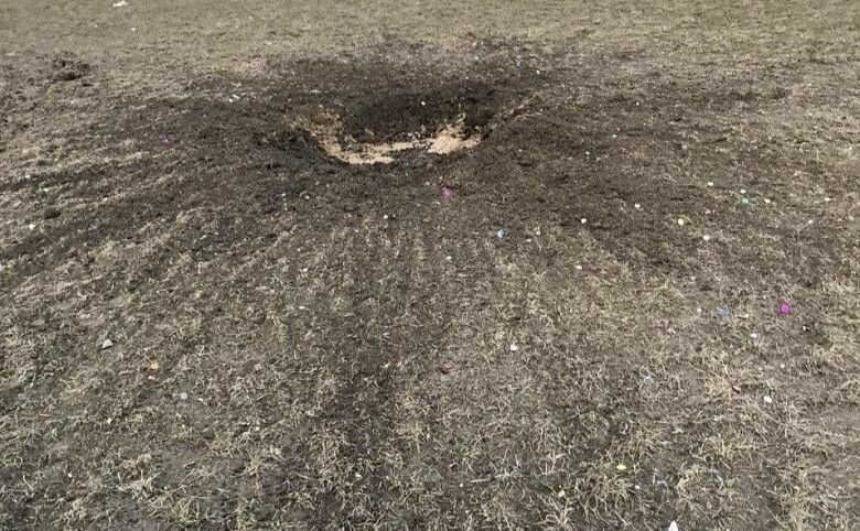Під час ворожого обстрілу на Сумщині постраждала жінка: лікарі дістали з її голови уламок
