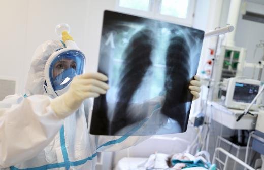 Ситуація із поширенням COVID-19 у Сумах погіршується