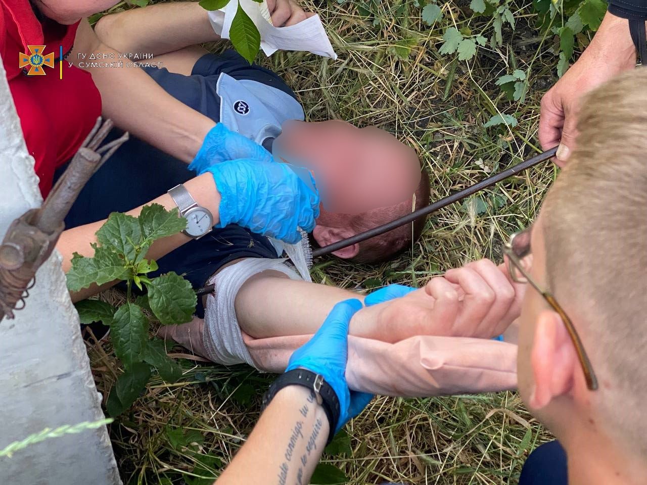 У Сумах рятувальники допомогли чоловіку, який нахромився на арматуру